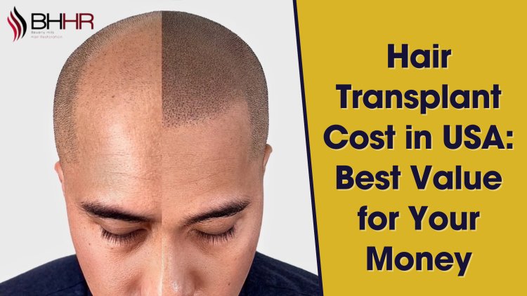 Hair Transplant Cost in USA: Best Value for Your Money